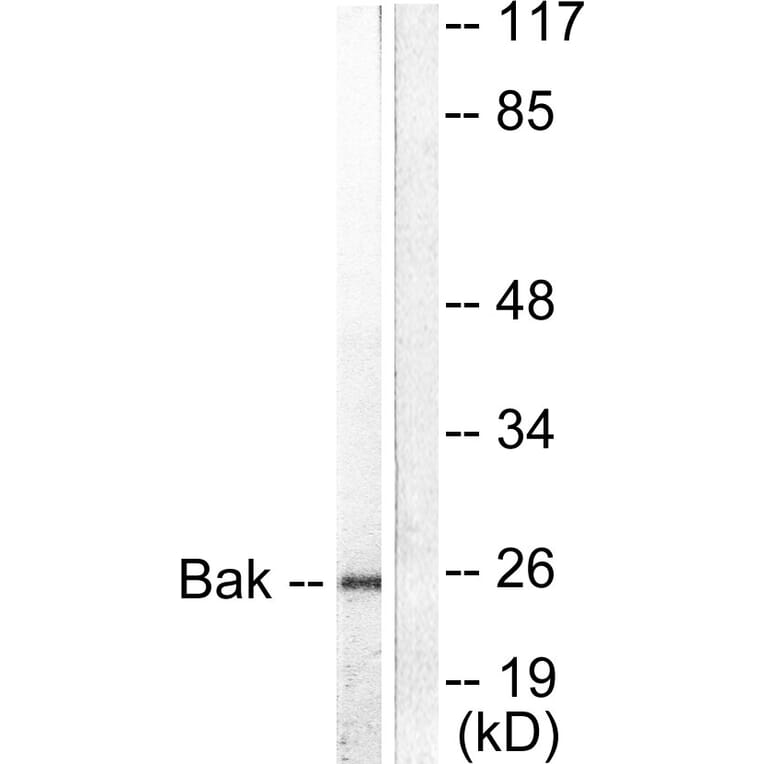 Western Blot - Anti-Bak Antibody (C0131) - Antibodies.com