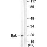 Western Blot - Anti-Bak Antibody (C0131) - Antibodies.com