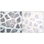 Immunohistochemistry - Anti-Bak Antibody (C0131) - Antibodies.com