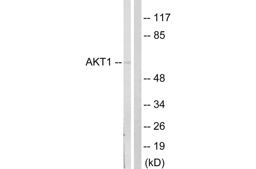 Western Blot - Anti-Akt Antibody (B0407) - Antibodies.com