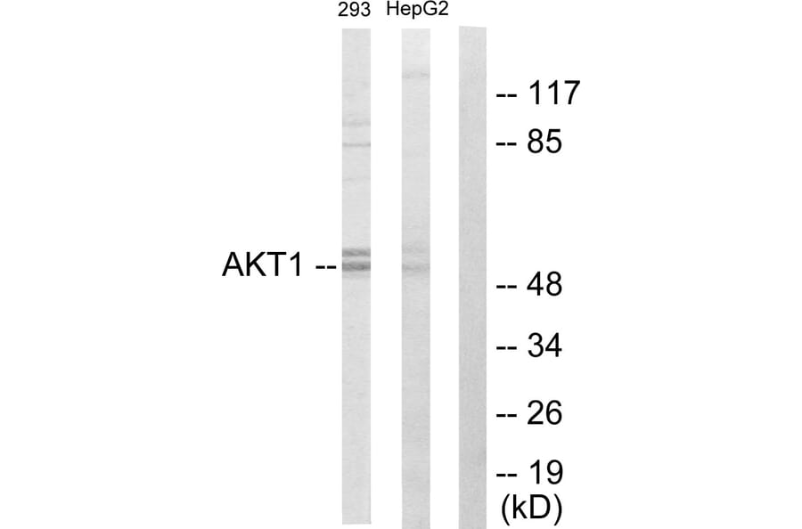 Western Blot - Anti-Akt Antibody (C10531) - Antibodies.com
