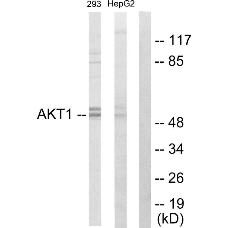 Western Blot - Anti-Akt Antibody (C10531) - Antibodies.com