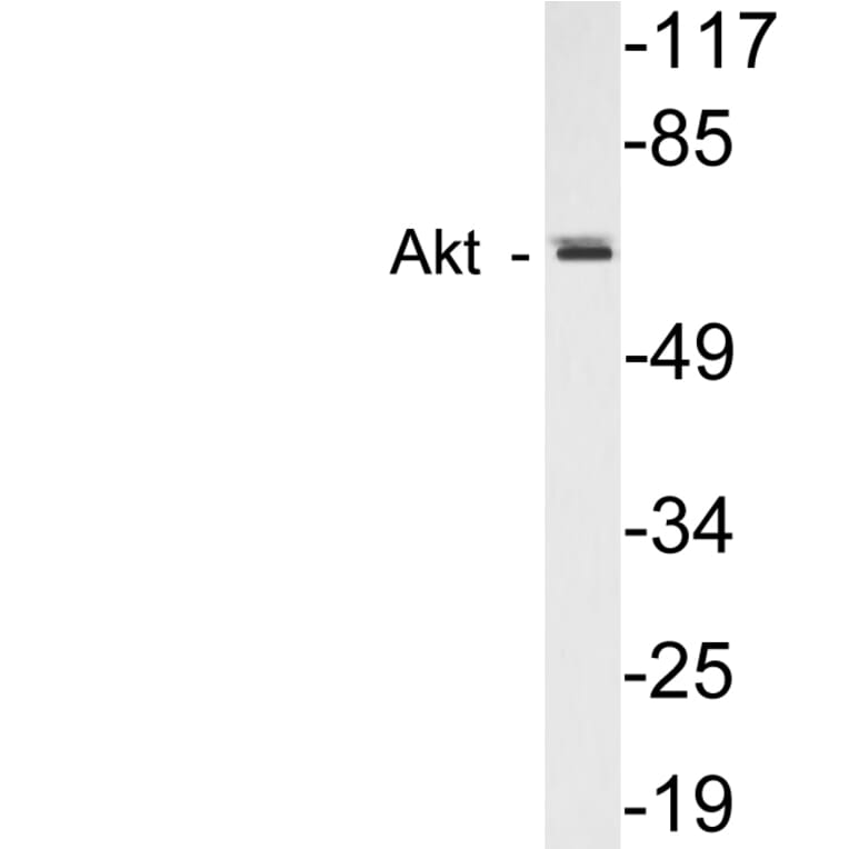 Western Blot - Anti-Akt Antibody (R12-2016) - Antibodies.com