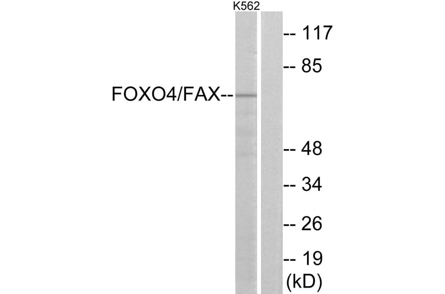 Western Blot - Anti-AFX Antibody (B7088) - Antibodies.com