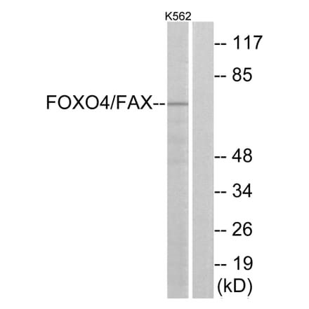 Western Blot - Anti-AFX Antibody (B7088) - Antibodies.com