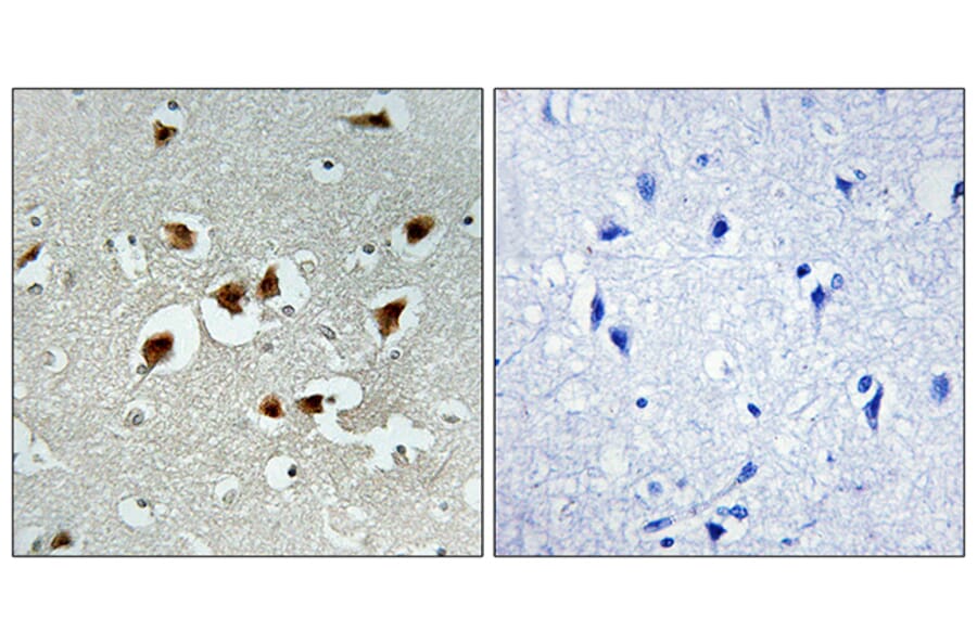 Immunohistochemistry - Anti-AFX Antibody (B7088) - Antibodies.com