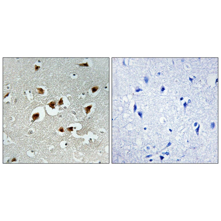 Immunohistochemistry - Anti-AFX Antibody (B7088) - Antibodies.com