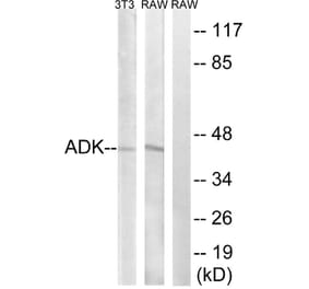Western Blot - Anti-ADK Antibody (C10739) - Antibodies.com