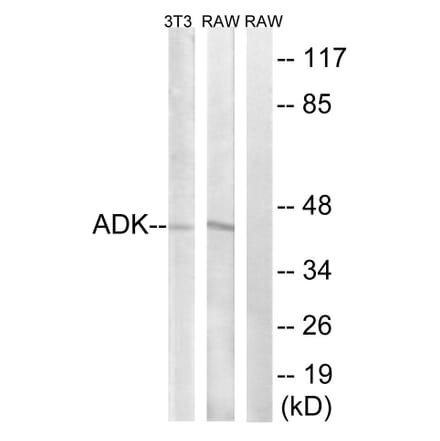 Western Blot - Anti-ADK Antibody (C10739) - Antibodies.com