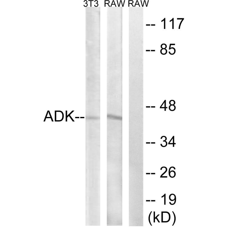 Western Blot - Anti-ADK Antibody (C10739) - Antibodies.com