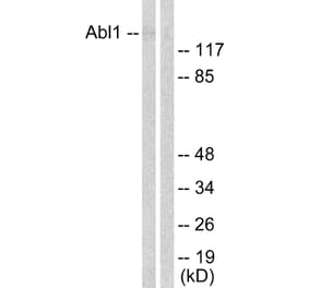 Western Blot - Anti-Abl Antibody (B0404) - Antibodies.com