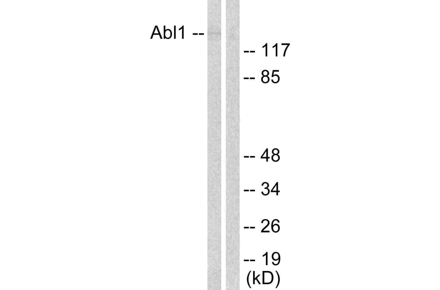Western Blot - Anti-Abl Antibody (B0404) - Antibodies.com