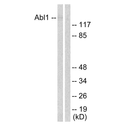 Western Blot - Anti-Abl Antibody (B0404) - Antibodies.com