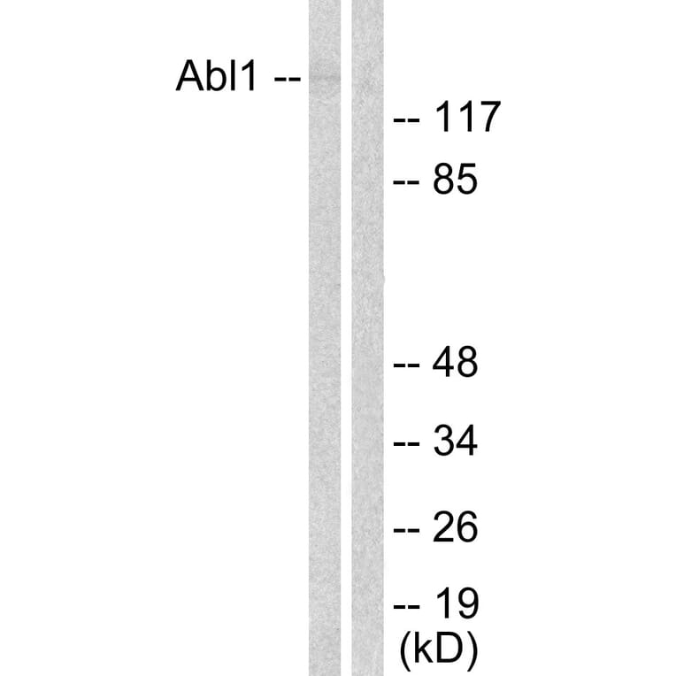 Western Blot - Anti-Abl Antibody (B0404) - Antibodies.com