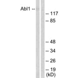 Western Blot - Anti-Abl Antibody (B0404) - Antibodies.com