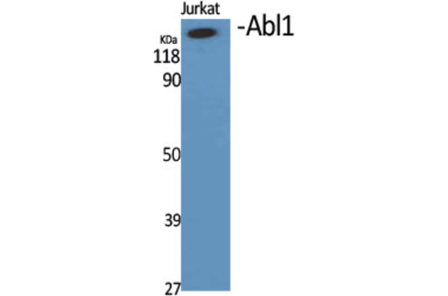 Western Blot - Anti-Abl Antibody (B0404) - Antibodies.com