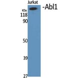 Western Blot - Anti-Abl Antibody (B0404) - Antibodies.com