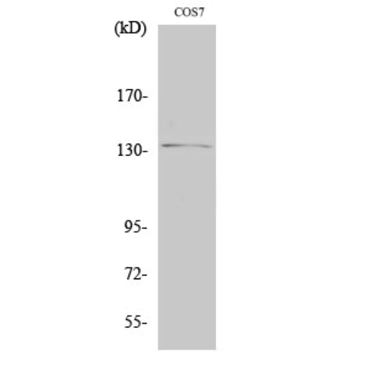 Western Blot - Anti-Abl Antibody (B0404) - Antibodies.com