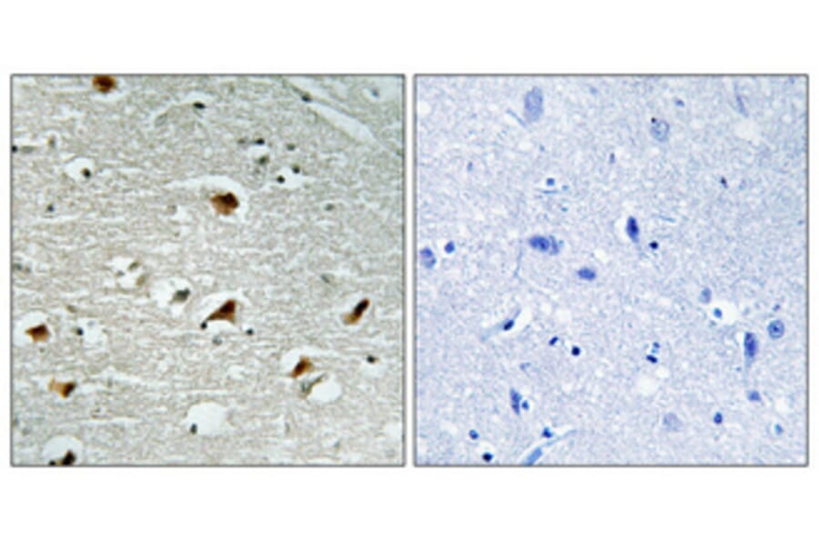 Immunohistochemistry - Anti-Abl Antibody (B0404) - Antibodies.com