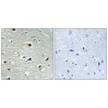 Immunohistochemistry - Anti-Abl Antibody (B0404) - Antibodies.com