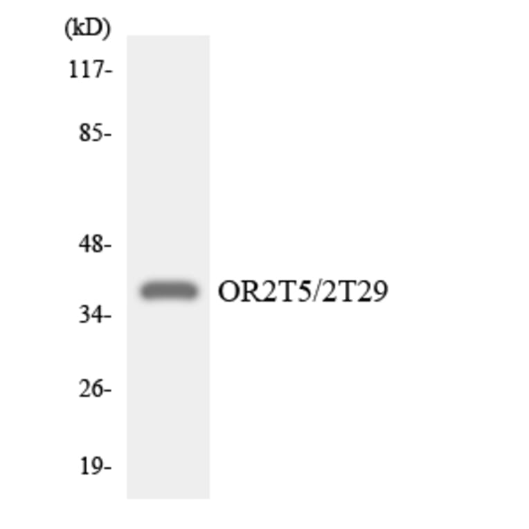 Western Blot - Anti-OR2T5 + OR2T29 Antibody (R12-3175) - Antibodies.com