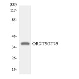 Western Blot - Anti-OR2T5 + OR2T29 Antibody (R12-3175) - Antibodies.com