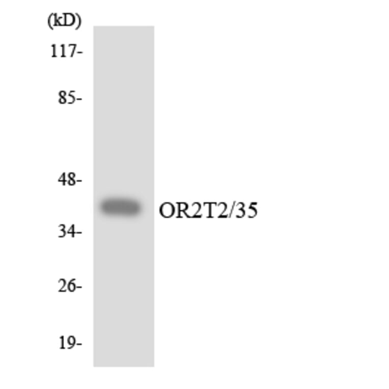 Western Blot - Anti-OR2T2 + OR2T35 Antibody (R12-3173) - Antibodies.com