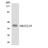 Western Blot - Anti-OR2T2 + OR2T35 Antibody (R12-3173) - Antibodies.com