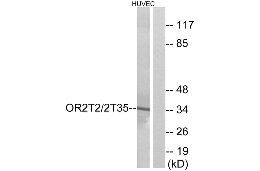 Western Blot - Anti-OR2T2 + OR2T35 Antibody (G440) - Antibodies.com