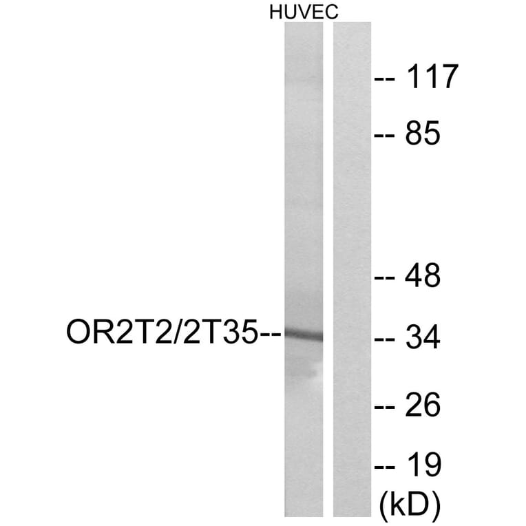 Western Blot - Anti-OR2T2 + OR2T35 Antibody (G440) - Antibodies.com