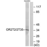 Western Blot - Anti-OR2T2 + OR2T35 Antibody (G440) - Antibodies.com