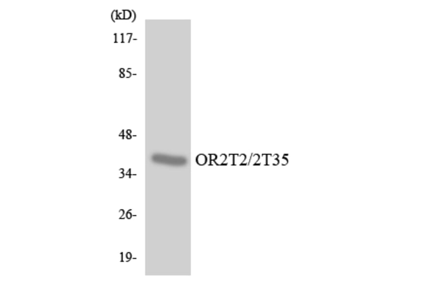 Western Blot - Anti-OR2T2 + OR2T35 Antibody (R12-3171) - Antibodies.com