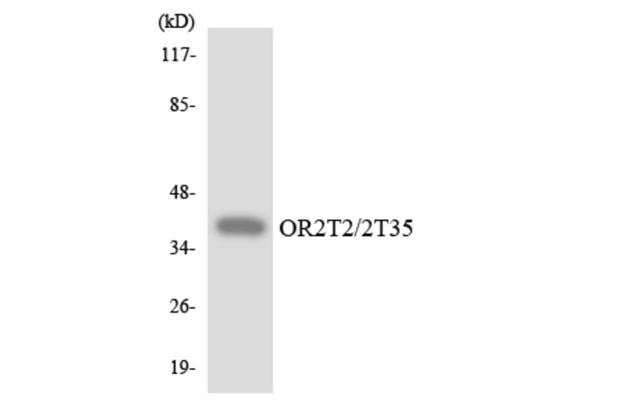 Western Blot - Anti-OR2T2 + OR2T35 Antibody (R12-3172) - Antibodies.com