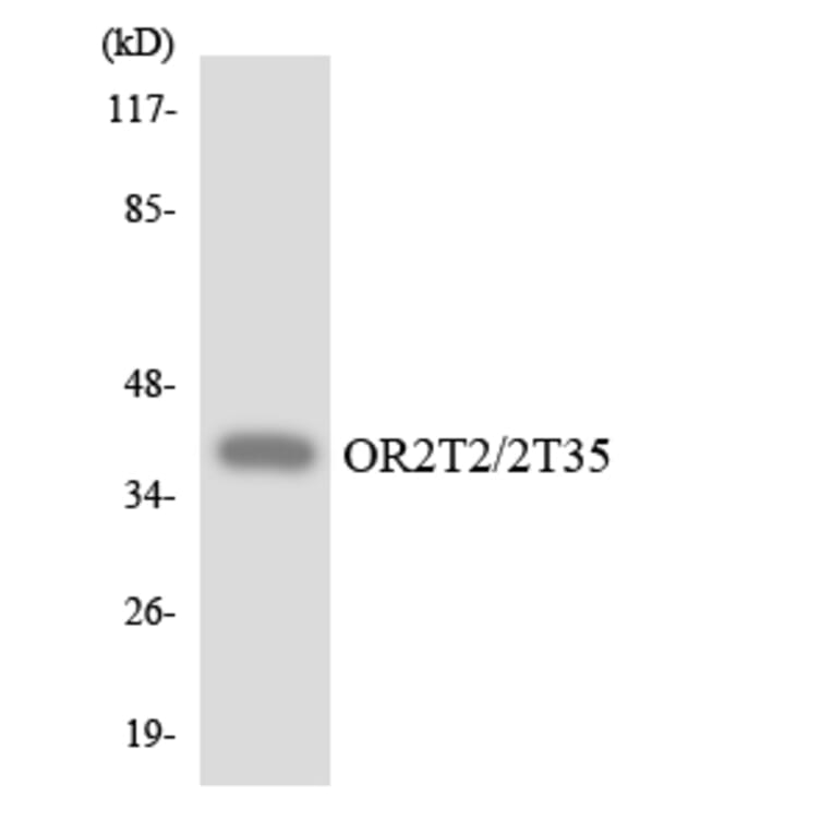 Western Blot - Anti-OR2T2 + OR2T35 Antibody (R12-3172) - Antibodies.com