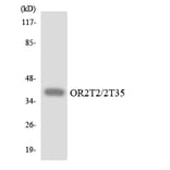 Western Blot - Anti-OR2T2 + OR2T35 Antibody (R12-3172) - Antibodies.com