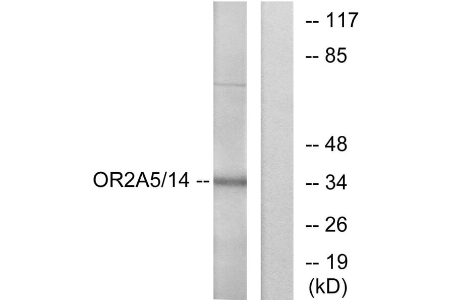 Western Blot - Anti-OR2A5 + OR2A14 Antibody (G429) - Antibodies.com