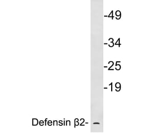 Western Blot - Anti-Defensin beta2 Antibody (R12-2116) - Antibodies.com