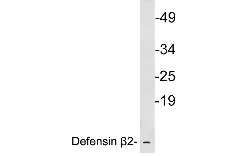 Western Blot - Anti-Defensin beta2 Antibody (R12-2116) - Antibodies.com
