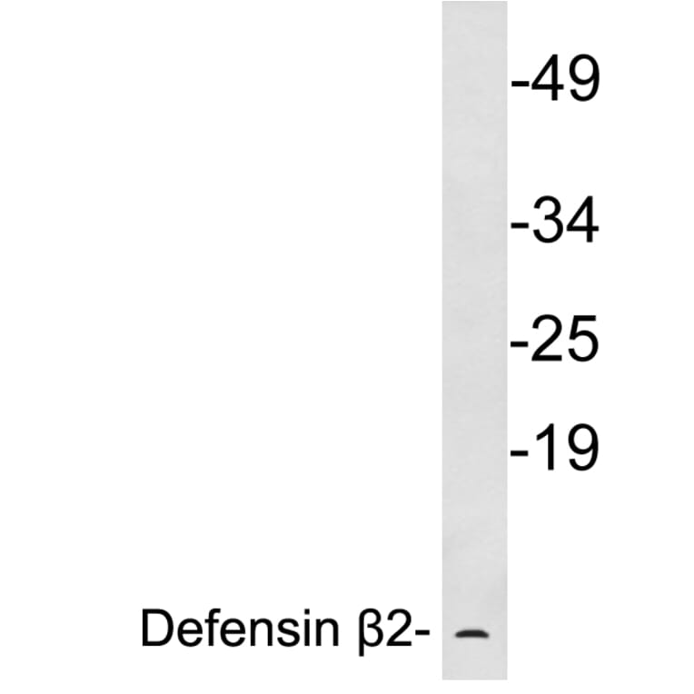 Western Blot - Anti-Defensin beta2 Antibody (R12-2116) - Antibodies.com