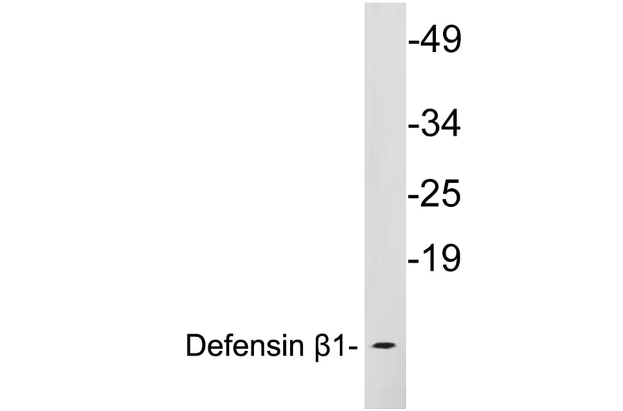 Western Blot - Anti-Defensin beta1 Antibody (R12-2115) - Antibodies.com