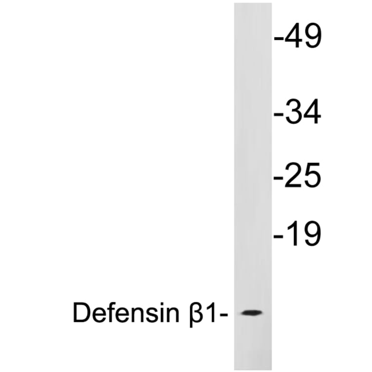 Western Blot - Anti-Defensin beta1 Antibody (R12-2115) - Antibodies.com