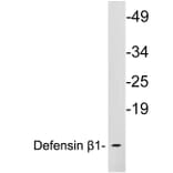 Western Blot - Anti-Defensin beta1 Antibody (R12-2115) - Antibodies.com