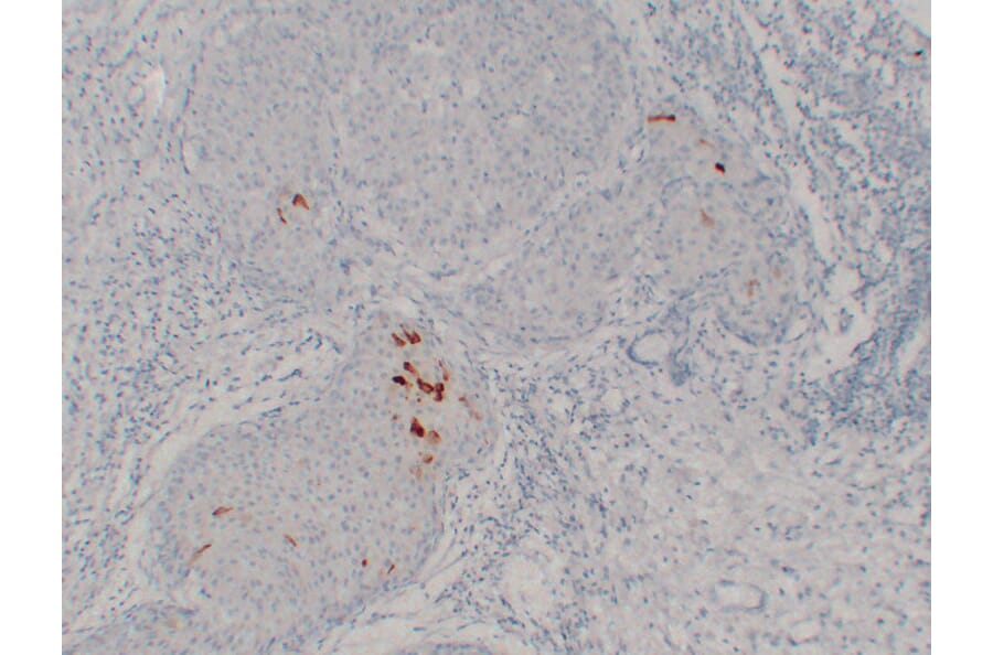 Immunohistochemistry - Anti-Mammaglobin Antibody (V0091) - Antibodies.com