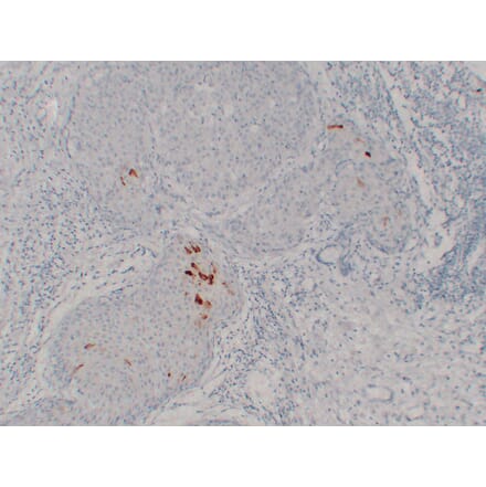 Immunohistochemistry - Anti-Mammaglobin Antibody (V0091) - Antibodies.com