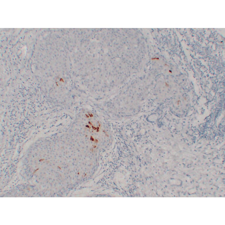 Immunohistochemistry - Anti-Mammaglobin Antibody (V0091) - Antibodies.com