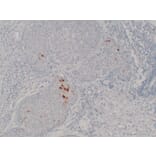 Immunohistochemistry - Anti-Mammaglobin Antibody (V0091) - Antibodies.com