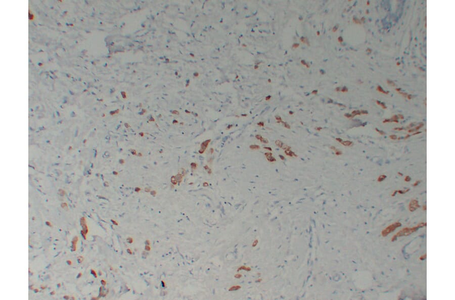 Immunohistochemistry - Anti-Mammaglobin Antibody (V0091) - Antibodies.com