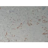 Immunohistochemistry - Anti-Mammaglobin Antibody (V0091) - Antibodies.com