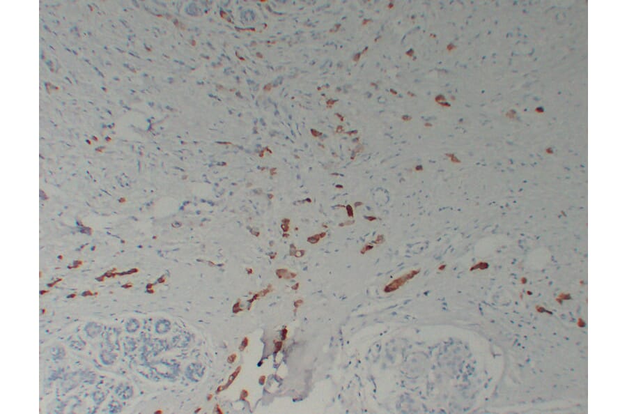 Immunohistochemistry - Anti-Mammaglobin Antibody (V0091) - Antibodies.com