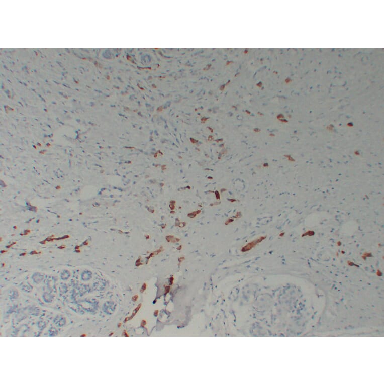 Immunohistochemistry - Anti-Mammaglobin Antibody (V0091) - Antibodies.com